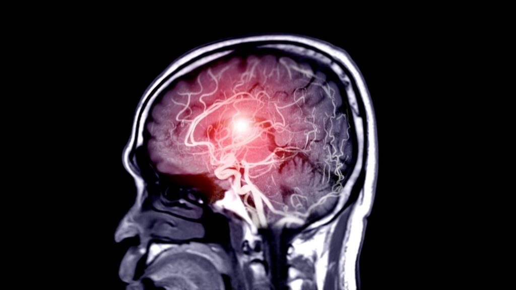 Cientistas usam ressonância magnética para prever o envelhecimento humano.