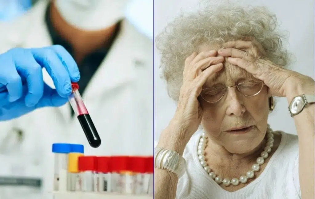Mão enluvada segurando tubo de sangue em laboratório ao lado de idosa com mãos na cabeça parecendo angustiada Brasileiro desenvolve exame capaz de detectar Alzheimer até 20 anos antes dos sintomas