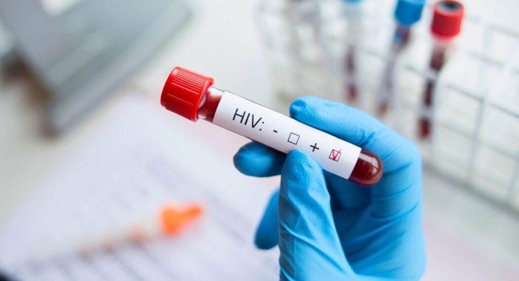 luva azul segurando tubo de ensaio com sangue rotulado HIV □ + ✓, indicando resultado positivo, com outros tubos ao fundo em ambiente laboratorial